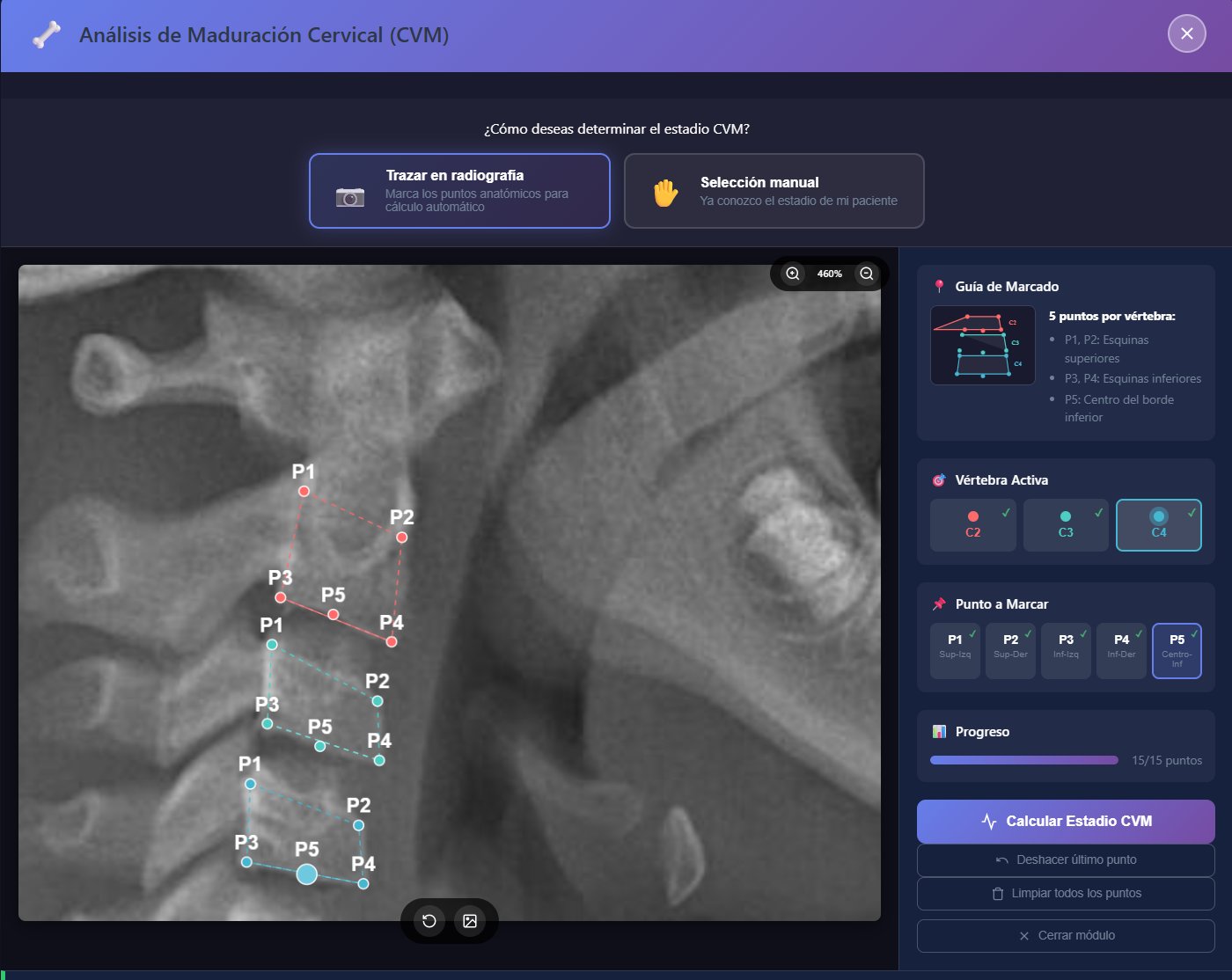 Referencia de Maduración Cervical CVM